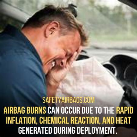 Rapid inflation, chemical reaction, and heat - Airbag Burns